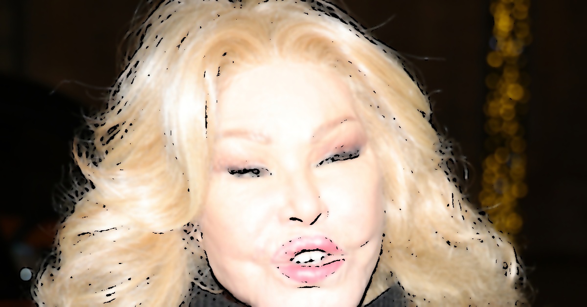 Kedi Kadın Jocelyn Wildenstein Hayatını Kaybetti