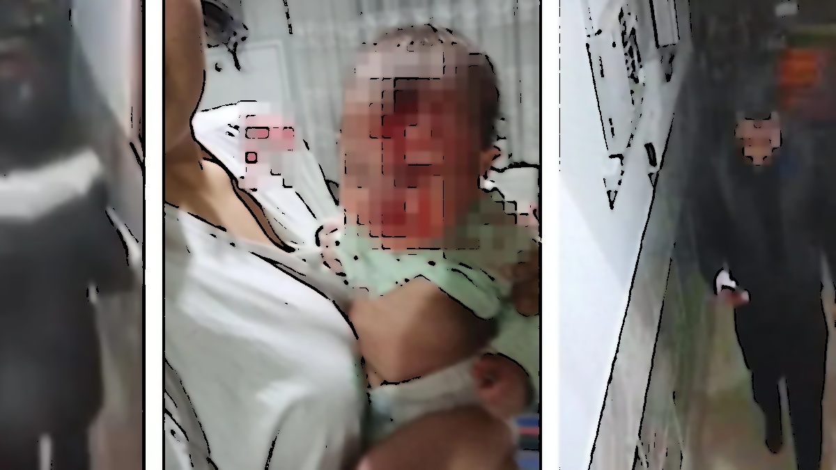 Ankara'da Şok Edici Bebek Yaralama Olayı: Baba Gözaltına Alındı